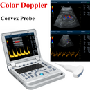 CONTEC Color Doppler Ultrasound Scanner Cardiac Diagnostic Machine Continuous Wave Doppler (CW) with Phased Array Probe