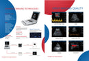 CONTEC Color Doppler Ultrasound Scanner Cardiac Diagnostic Machine Continuous Wave Doppler (CW) with Phased Array Probe