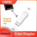 CMS1600A Color Doppler Ultrasound Scanner Wifi Wireless Machine Software 2 Probe