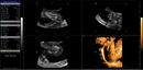 CONTEC Color Doppler Ultrasound Scanner Cardiac Diagnostic Machine Continuous Wave Doppler (CW) with Phased Array Probe