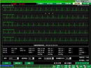 CONTEC CMS9000 Central Monitoring System,Networked to CONTEC Patient Monitor