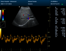 Veterinary Color Doppler Ultrasound with Convex Probe CF/PW