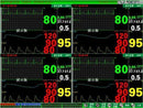 CONTEC CMS9000 Central Monitoring System,Networked to CONTEC Patient Monitor