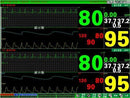 CONTEC CMS9000 Central Monitoring System,Networked to CONTEC Patient Monitor