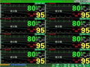 CONTEC CMS9000 Central Monitoring System,Networked to CONTEC Patient Monitor