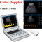CONTEC Color Doppler Ultrasound Scanner Cardiac Diagnostic Machine Continuous Wave Doppler (CW) with Phased Array Probe