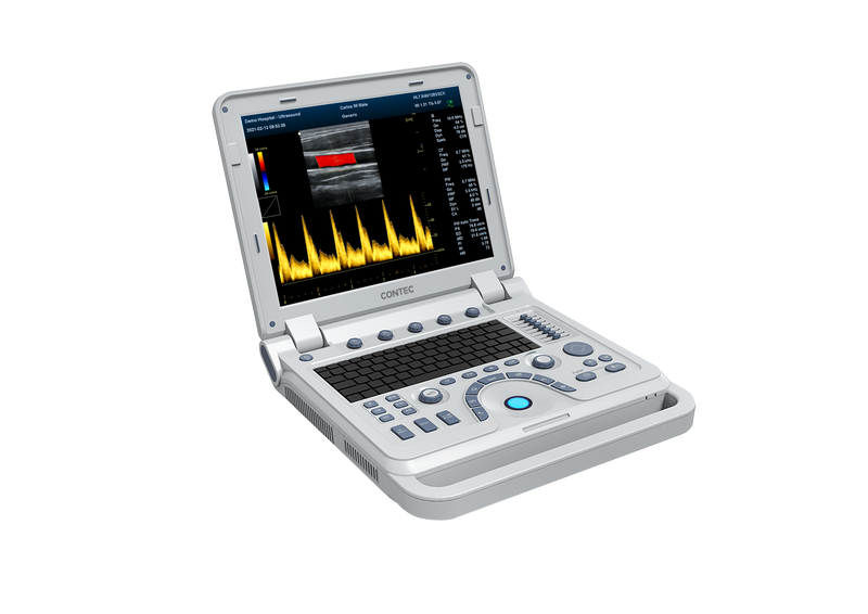 CONTEC Color Doppler Ultrasound Scanner Cardiac Diagnostic Machine Continuous Wave Doppler (CW) with Phased Array Probe