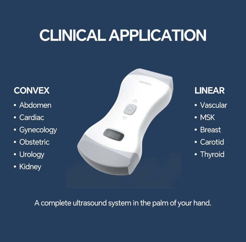 Wifi Wireless Color Ultrasound Doppler convex + linear array Probe IOS – ContecEurope