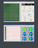 CONTEC KT88-1016 Digital 16-Channel EEG Machine And Mapping System, Software