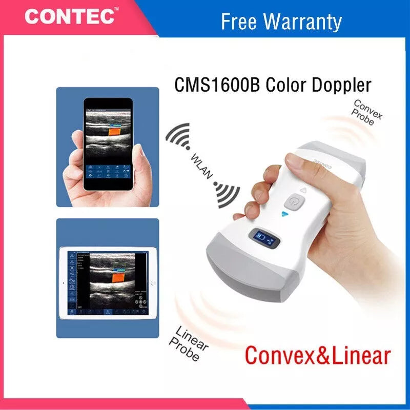 Wifi Wireless Color Ultrasound Doppler convex + linear array Probe IOS Android