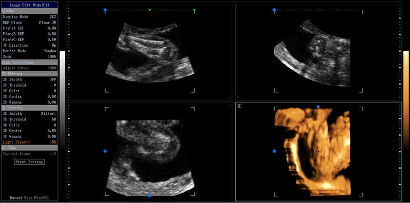 CONTEC Color Doppler Ultrasound Scanner Cardiac Diagnostic Machine Continuous Wave Doppler (CW) with Phased Array Probe