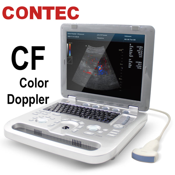 CMS1600A Color Doppler Ultrasound Scanner Wifi Wireless Machine Softwa –  ContecEurope