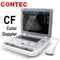 CONTEC Color Doppler Ultrasound Scanner Machine CF PW Ultrasound Machine with Convex Probe