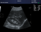 CMS600P2PLUS-VET B-Ultrasound Scanner Diagnostic System PW Color Doppler 15″ Inch Screen