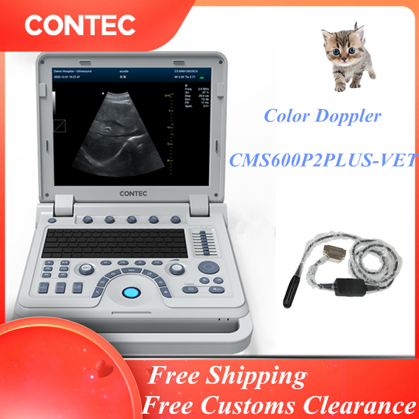 Contec Fetal Doppler (2 Mhz Probe) – Medisave UK
