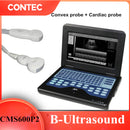 CONTEC CMS600P2 10.1 Inch Portable Ultrasound Scanner Laptop Machine For Human FDA CE