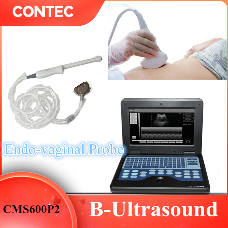 CONTEC CMS600P2PLUS B-scanner à ultrasons nouvelle machine toutes sort