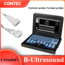 CONTEC CMS600P2 10.1 Inch Portable Ultrasound Scanner Laptop Machine For Human FDA CE