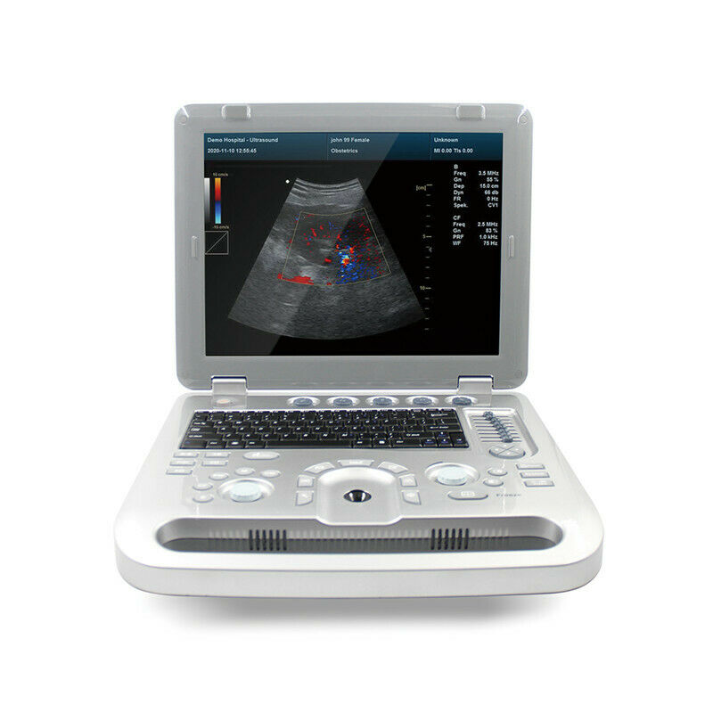 CONTEC Color Doppler Ultrasound Scanner Machine CF PW Ultrasound Machine with Convex Probe
