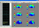 24-hour Pocket Dynamic EEG System,16 channels carrying recording EEG Holter