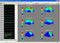 24-hour Pocket Dynamic EEG System,16 channels carrying recording EEG Holter