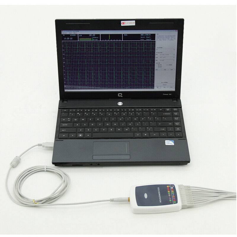 CONTEC8000GW 12-lead Resting ECG/EKG Workstation System PC Software ELECTORDES