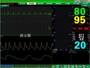 CONTEC CMS9000 Central Monitoring System,Networked to CONTEC Patient Monitor